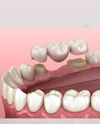 Treatment - Ninety 2 Dental