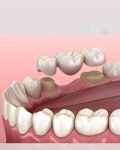 Treatements  - ninety2dental