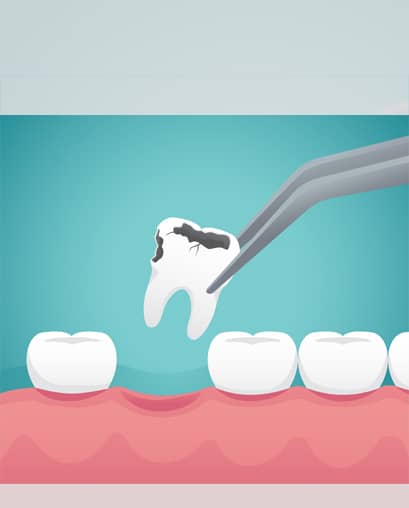 Treatements  - ninety2dental