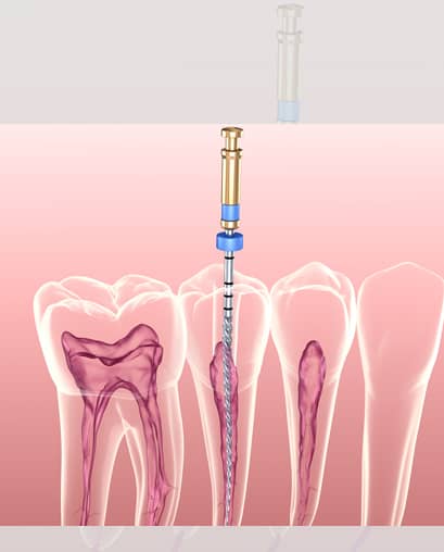 Treatment - Ninety 2 Dental